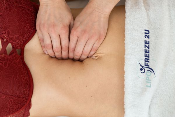 diastasis recti treatment Portsmouth