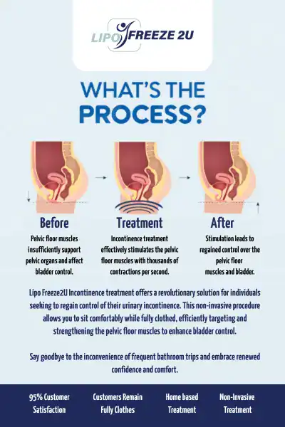 Diagram of how incontinence treatment Portsmouth works.