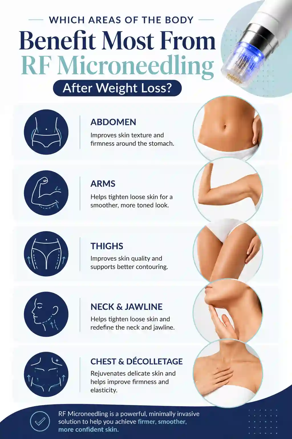 Which Areas of the Body Benefit Most From RF Microneedling After Weight Loss Portsmouth